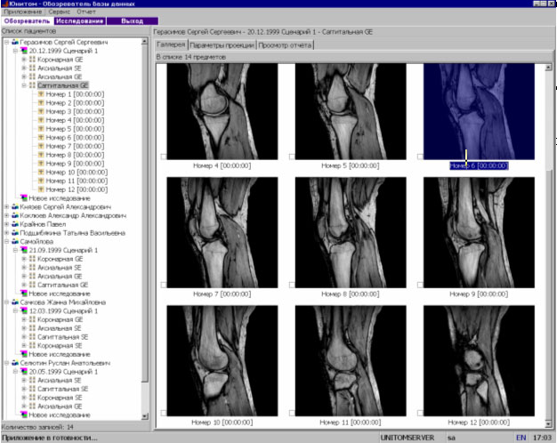 Магнітно-резонансний томограф «Юнітом» - програмне забезпечення